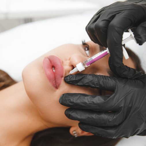 female lips, lip augmentation procedure. A syringe near a woman's mouth, injections to increase the shape of the lips