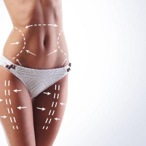 Female,Body,With,The,Drawing,Arrows,On,It.,Fat,Lose,